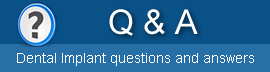 Dental implant questions and answers